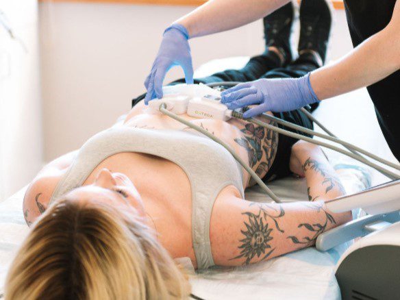 trusculpt® id patient